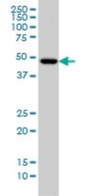 Western Blot: Iroquois-class homeodomain protein IRX-5 Antibody (6A9) [H00010265-M10]