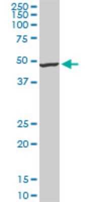 Western Blot: Iroquois-class homeodomain protein IRX-5 Antibody (6A9) [H00010265-M10]