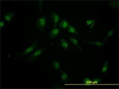 Immunocytochemistry/ Immunofluorescence: Iroquois-class homeodomain protein IRX-5 Antibody (6B5) [H00010265-M01]