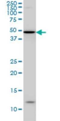 Western Blot: Iroquois-class homeodomain protein IRX-5 Antibody (6B5) [H00010265-M01]