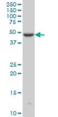 Western Blot: Iroquois-class homeodomain protein IRX-5 Antibody (8A12) [H00010265-M06]