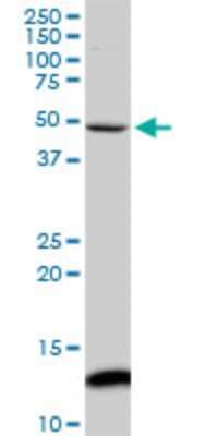 Western Blot: Iroquois-class homeodomain protein IRX-5 Antibody (8A12) [H00010265-M06]