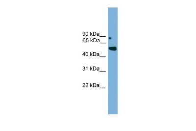 Western Blot: Iroquois-class homeodomain protein IRX-5 Antibody [NBP3-10426]