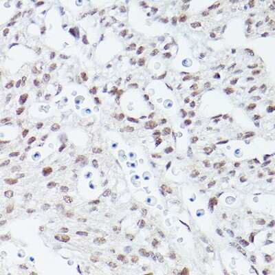 Immunohistochemistry-Paraffin: Islet-1 Antibody (1G9Q8) [NBP3-15315]