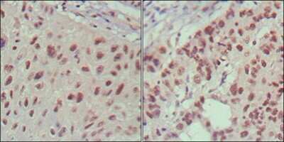 Immunohistochemistry-Paraffin: Islet-1 Antibody (1H9) - BSA Free [NBP1-47537]