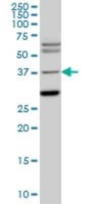 Western Blot: Islet-1 Antibody (2E7) [H00003670-M05]