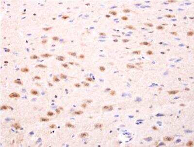 Immunohistochemistry-Paraffin: Islet-1 Antibody [NBP2-14999]