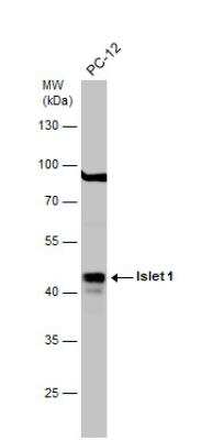 Western Blot: Islet-1 Antibody [NBP2-14999]