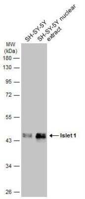 Western Blot: Islet-1 Antibody [NBP2-14999]