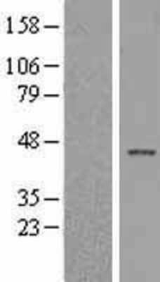 Western Blot: Islet-1 Overexpression Lysate [NBL1-12050]