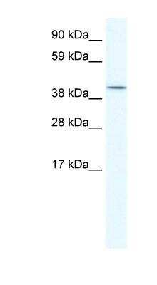 Western Blot: Islet-2 Antibody [NBP1-91535]