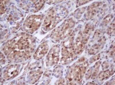Immunohistochemistry: Isocitrate Dehydrogenase 1/IDH1 Antibody (OTI1D1) [NBP2-46019]