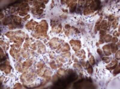 Immunohistochemistry: Isocitrate Dehydrogenase 1/IDH1 Antibody (OTI1D1) [NBP2-46019]