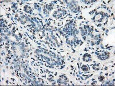 Immunohistochemistry-Paraffin: Isocitrate Dehydrogenase 1/IDH1 Antibody (OTI2H9) [NBP1-47804]