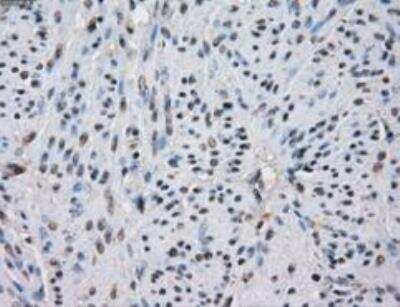 Immunohistochemistry-Paraffin: Isocitrate Dehydrogenase 1/IDH1 Antibody (OTI2H9) [NBP1-47804]