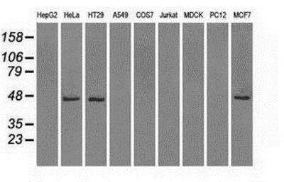 Western Blot: Isocitrate Dehydrogenase 1/IDH1 Antibody (OTI2H9) [NBP1-47804]