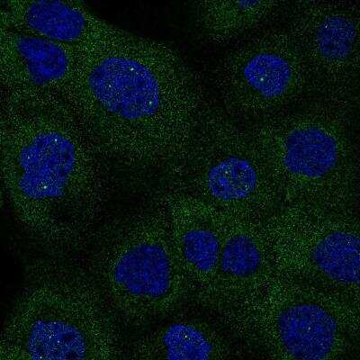 Immunocytochemistry/ Immunofluorescence: Isocitrate Dehydrogenase 1/IDH1 Antibody (CL0219) [NBP2-52882]
