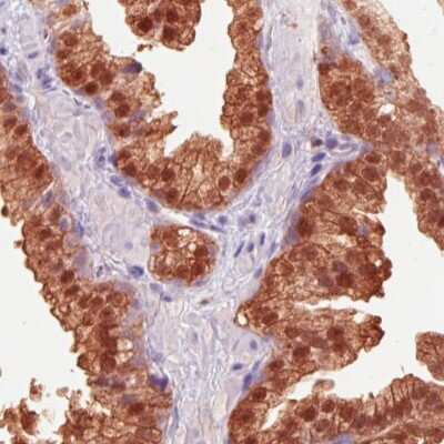 Immunohistochemistry-Paraffin: Isocitrate Dehydrogenase 1/IDH1 Antibody (CL0219) [NBP2-52882]