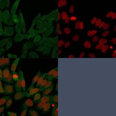 Immunocytochemistry/ Immunofluorescence: Isocitrate Dehydrogenase 1/IDH1 Antibody (IDH1/1152) [NBP2-45156]