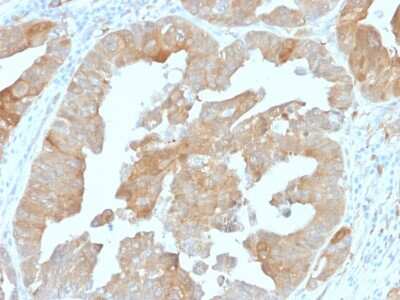 Immunohistochemistry-Paraffin: Isocitrate Dehydrogenase 1/IDH1 Antibody (IDH1/1152) [NBP2-45156]