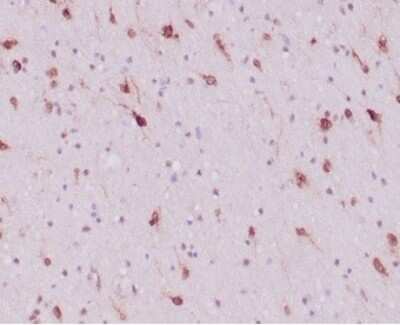 Immunohistochemistry-Paraffin: Isocitrate Dehydrogenase 1/IDH1 Antibody (IDH1/6806R) [NBP3-13943]