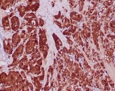 Immunohistochemistry-Paraffin: Isocitrate Dehydrogenase 1/IDH1 Antibody (IDH1/6806R) [NBP3-13943]