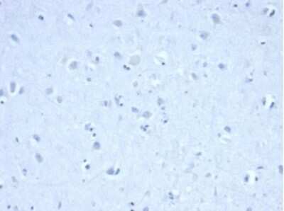 Immunohistochemistry-Paraffin: Isocitrate Dehydrogenase 1/IDH1 Antibody (IDH1/6806R) [NBP3-13943]