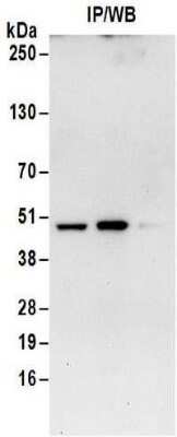 Immunoprecipitation: Isocitrate Dehydrogenase 1/IDH1 Antibody [NBP2-32150]