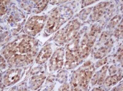 Immunohistochemistry: Isocitrate Dehydrogenase 1/IDH1 Antibody (OTI1D1) - Azide and BSA Free [NBP2-70990]