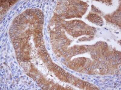 Immunohistochemistry: Isocitrate Dehydrogenase 1/IDH1 Antibody (OTI1D1) - Azide and BSA Free [NBP2-70990]
