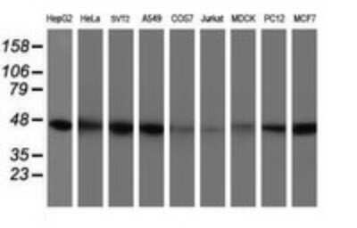 Western Blot: Isocitrate Dehydrogenase 1/IDH1 Antibody (OTI1D1)Azide and BSA Free [NBP2-70990]