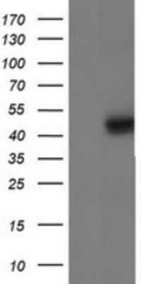 Western Blot: Isocitrate Dehydrogenase 1/IDH1 Antibody (OTI1D1)Azide and BSA Free [NBP2-70990]