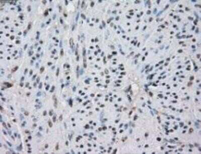 Immunohistochemistry: Isocitrate Dehydrogenase 1/IDH1 Antibody (OTI2H9) - Azide and BSA Free [NBP2-70988]
