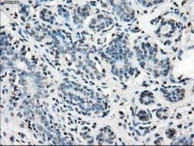 Immunohistochemistry: Isocitrate Dehydrogenase 1/IDH1 Antibody (OTI2H9) - Azide and BSA Free [NBP2-70988]