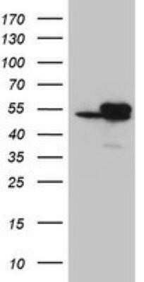 Western Blot: Isocitrate Dehydrogenase 1/IDH1 Antibody (OTI3G9)Azide and BSA Free [NBP2-70989]