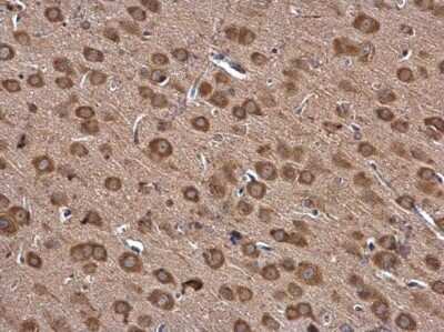Immunohistochemistry-Paraffin: Isoleucyl tRNA synthetase Antibody [NBP3-13037]