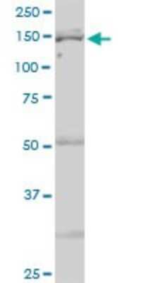 Western Blot: Isoleucyl tRNA synthetase Antibody [H00003376-B01P]
