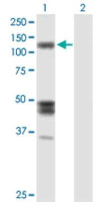 Western Blot: Isoleucyl tRNA synthetase Antibody [H00003376-B01P]