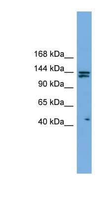 Western Blot: Isoleucyl tRNA synthetase Antibody [NBP1-55357]