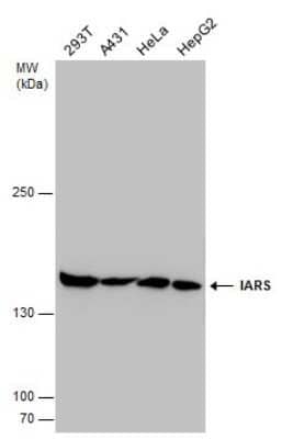 Western Blot: Isoleucyl tRNA synthetase Antibody [NBP3-13037]