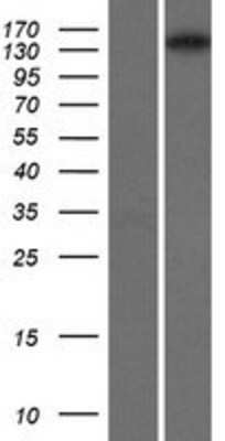 Western Blot: Isoleucyl tRNA synthetase Overexpression Lysate [NBP2-10340]