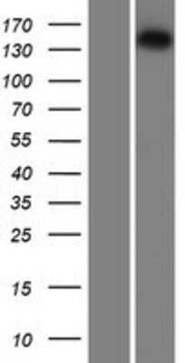 Western Blot: Isoleucyl tRNA synthetase Overexpression Lysate [NBP2-10809]