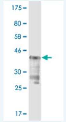 Western Blot: Isopeptidase T/USP5 Antibody (4G4) [H00008078-M02]