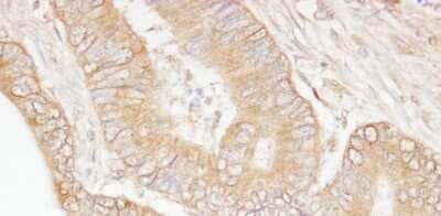 Immunohistochemistry: Isopeptidase T/USP5 Antibody [NB100-77286]