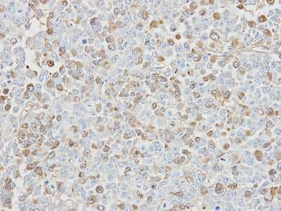 Immunohistochemistry-Paraffin: Isopeptidase T/USP5 Antibody [NBP1-32590]
