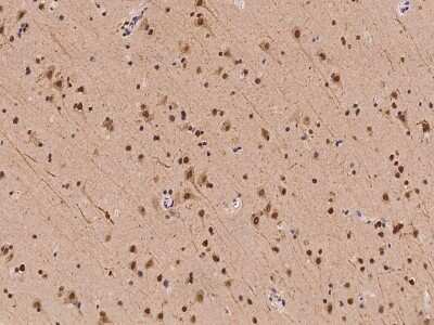 Immunohistochemistry-Paraffin: Isopeptidase T/USP5 Antibody [NBP2-97889]