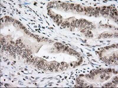 Immunohistochemistry: Isopeptidase T/USP5 Antibody (OTI2E3) - Azide and BSA Free [NBP2-71355]
