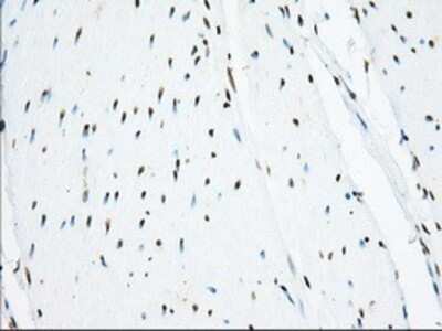 Immunohistochemistry: Isopeptidase T/USP5 Antibody (OTI2E3) - Azide and BSA Free [NBP2-71355]