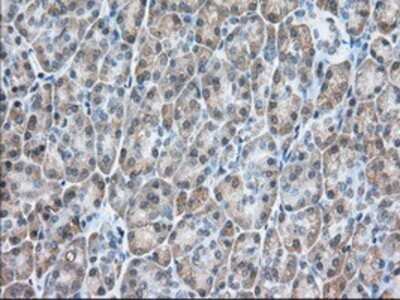 Immunohistochemistry: Isopeptidase T/USP5 Antibody (OTI2E3) - Azide and BSA Free [NBP2-71355]