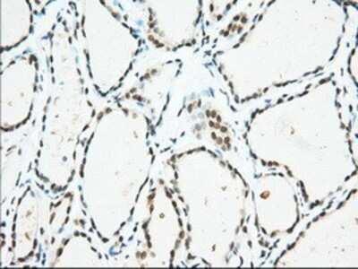 Immunohistochemistry: Isopeptidase T/USP5 Antibody (OTI2E3) - Azide and BSA Free [NBP2-71355]